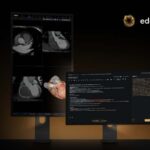 Eden anuncia la llegada de AI Report