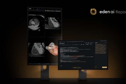Eden anuncia la llegada de AI Report