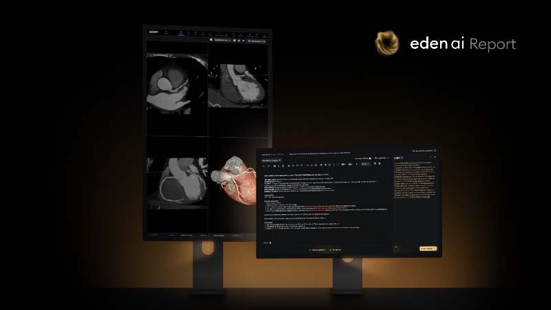 Eden anuncia la llegada de AI Report
