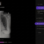 Telefónica y Harrison.ai se alían para apoyar el diagnóstico en radiografías