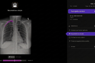 Telefónica y Harrison.ai se alían para apoyar el diagnóstico en radiografías